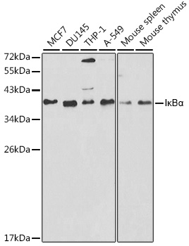 [KO Validated] IkBAlpha Rabbit Polyclonal Antibody (CAB11397)