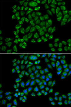 Anti-GRIA3 Antibody (CAB13993)