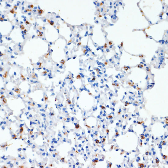 Anti-SFTPC Antibody (CAB1835)