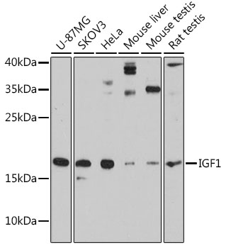 Anti-IGF1 Antibody (CAB11985)