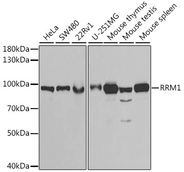 Anti-RRM1 Antibody (CAB13348)