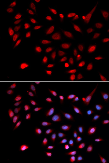 Anti-CDK9 Antibody (CAB1564)