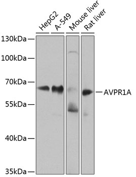 Anti-AVPR1A Polyclonal Antibody (CAB8400)