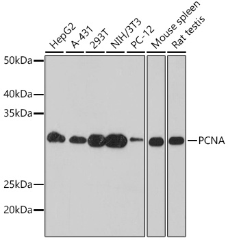 Anti-PCNA Monoclonal Antibody (CAB9909)