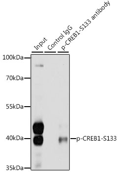 Anti-Phospho-CREB1-S133 Antibody (CABP0019)