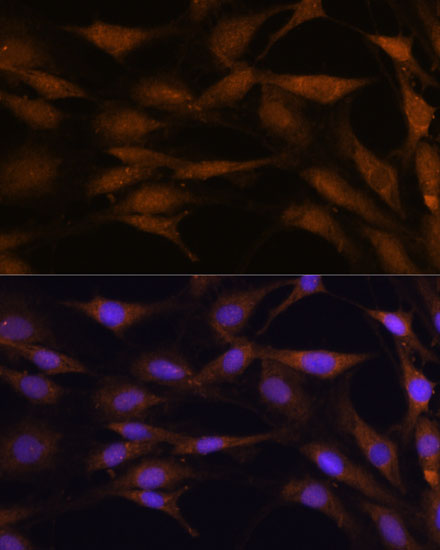 Anti-TFAP4 Antibody [KO Validated] (CAB16727)