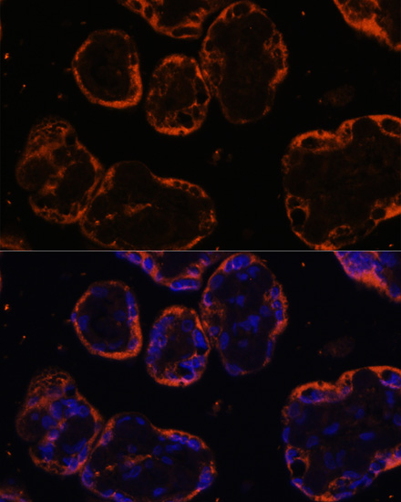 Anti-PSG1 Antibody (CAB6399)