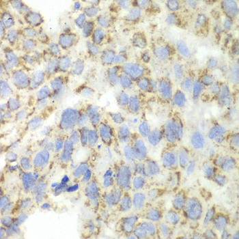 Anti-ALDH4A1 Antibody (CAB13569)