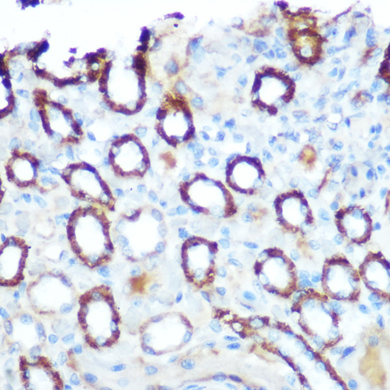 Anti-LONP1 Antibody (CAB4293)