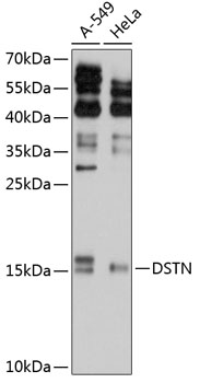 Anti-DSTN Antibody (CAB11603)