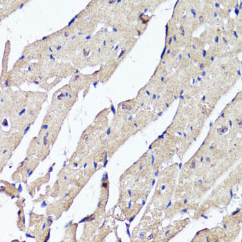 Anti-ACSS2 Antibody (CAB6472)