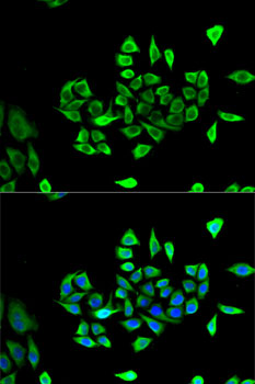 Anti-CLCN5 Antibody (CAB5707)