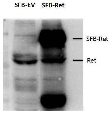 Western blot