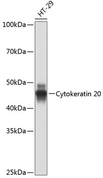 Anti-Cytokeratin 20 Antibody (CAB19041)