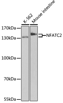 Anti-NFATC2 Antibody (CAB3107)