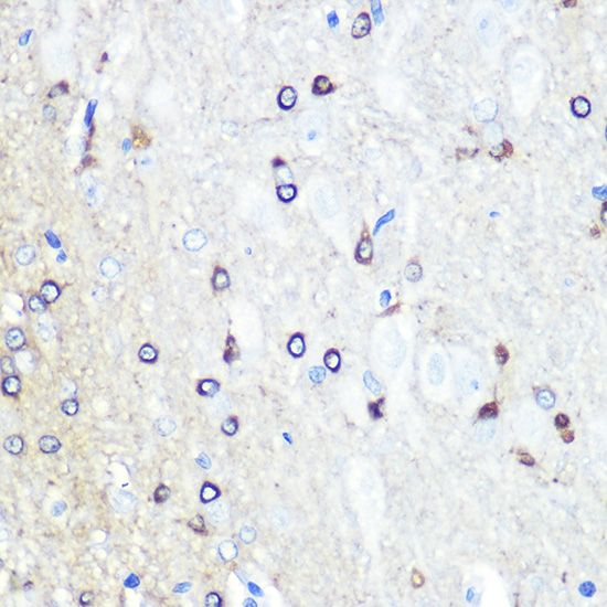 Anti-Tau Antibody (CAB0002)