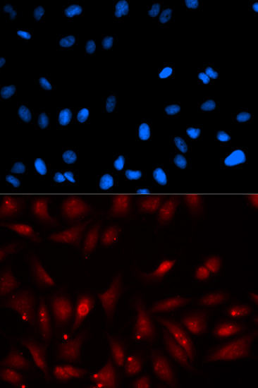 Anti-PA2G4 Antibody (CAB5376)