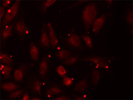 Anti-PCCB Antibody (CAB5415)