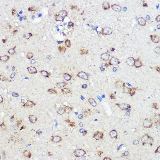 Anti-LRRC59 Antibody [KO Validated] (CAB17178)