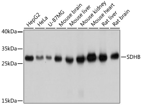 Anti-SDHB Antibody (CAB10821)