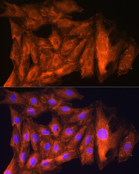 Anti-CKAP5 Polyclonal Antibody (CAB8532)