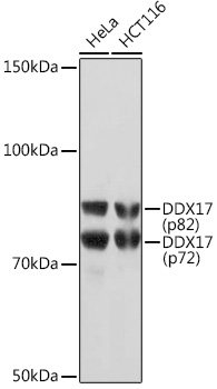 Anti-DDX17 Antibody (CAB5731)