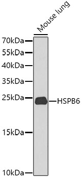 Anti-HSPB6 Polyclonal Antibody (CAB9887)