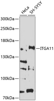 Anti-ITGA11 Antibody (CAB10084)