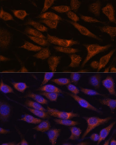 Anti-UNC13B Antibody (CAB15780)