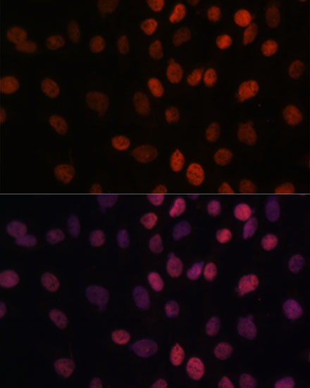 Anti-ARID1B Antibody (CAB15488)