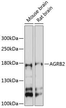 Anti-AGRB2 Antibody (CAB12380)