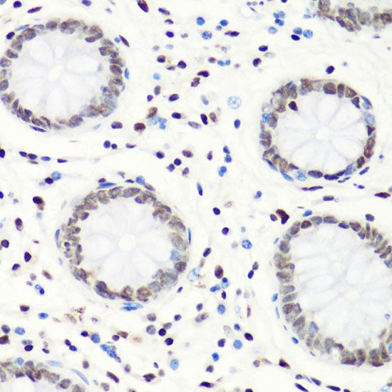 Anti-MonoMethyl-Histone H4-R3 Antibody (CAB3158)