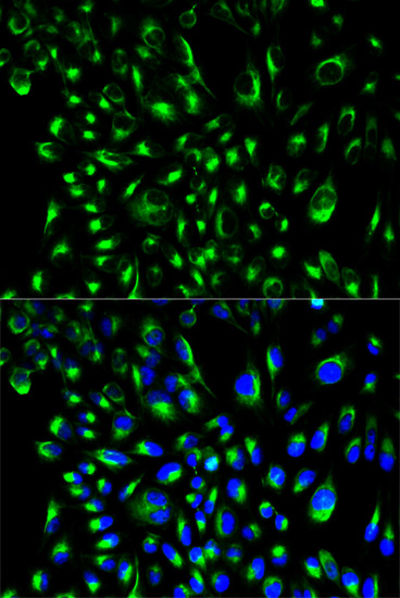 Anti-LCP2 Antibody (CAB13505)