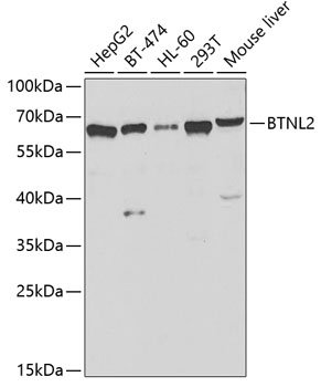 Anti-BTNL2 Antibody (CAB7120)