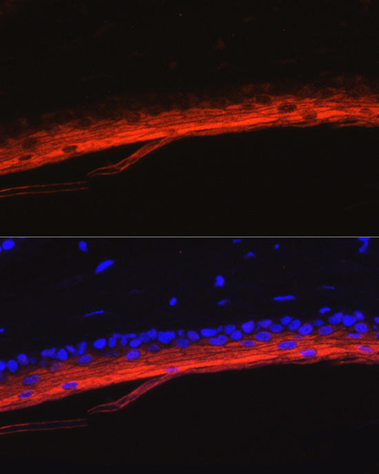 Immunofluorescence analysis of mouse skin using KRT80 Rabbit pAb at dilution of 1:50 (40x lens). Blue: DAPI for nuclear staining.