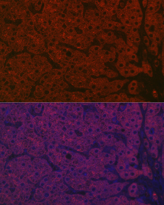 Anti-ASGR1 Antibody (CAB13279)