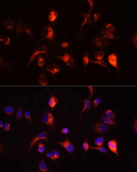 Anti-TOR1A Antibody (CAB2066)