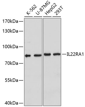 Anti-IL-22RA1 Antibody (CAB10941)