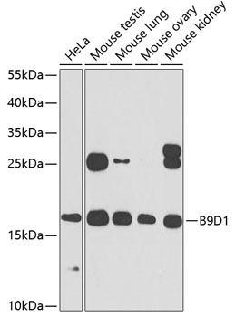 Anti-B9D1 Polyclonal Antibody (CAB7973)