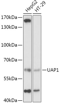 Anti-UAP1 Antibody (CAB2119)