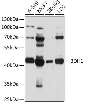 Anti-BDH1 Antibody (CAB3763)