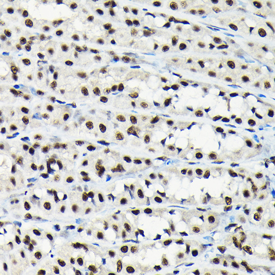 Anti-EFTUD2 Antibody (CAB7040)