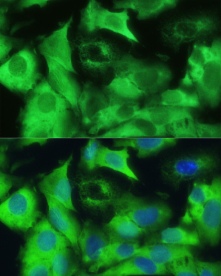 Anti-EZR Antibody (CAB0703)