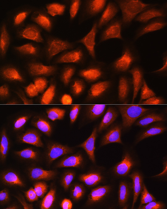 Anti-FTL Antibody (CAB1768)