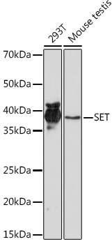 Anti-SET Antibody (CAB9173)