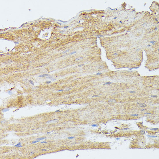 Anti-MAP2K5 Antibody (CAB6953)