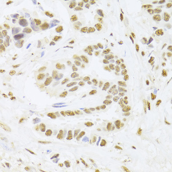 Anti-ANP32A Antibody (CAB5768)