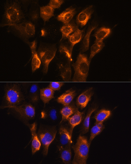 Anti-ADRB3 Polyclonal Antibody (CAB8607)