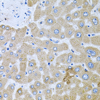 Anti-POMGNT1 Polyclonal Antibody (CAB9879)