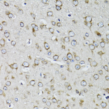 Anti-RPS10 Antibody (CAB5880)